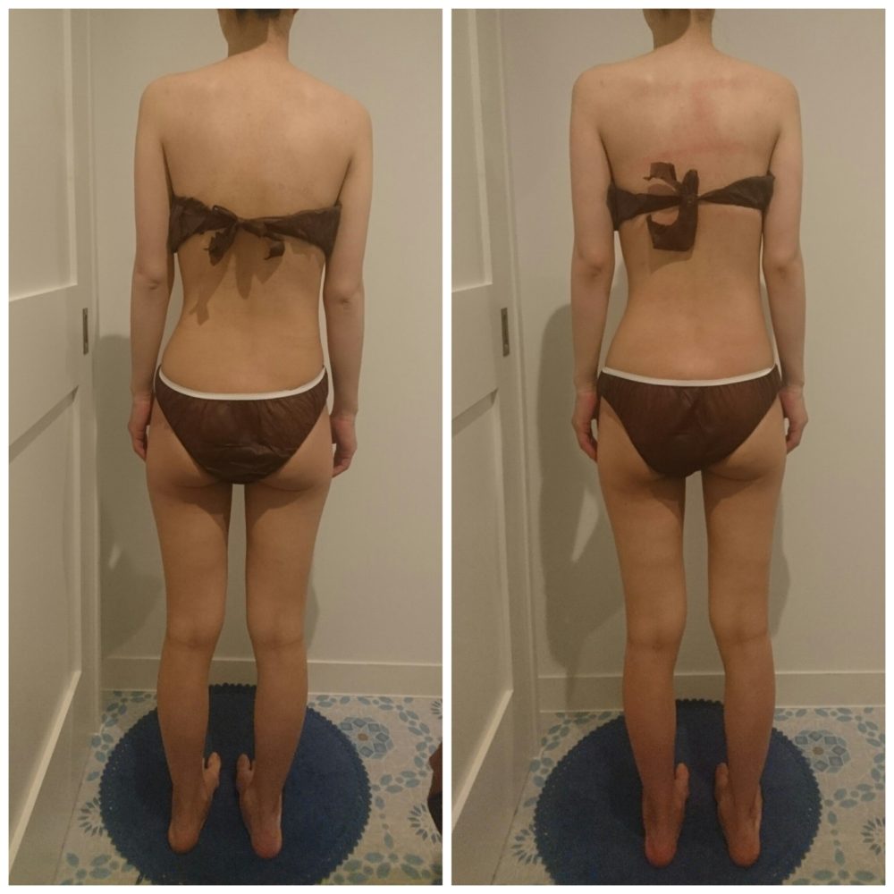 硬くなった筋肉がゆるんで体スッキリ！とろける筋膜ケア+ヘット100分