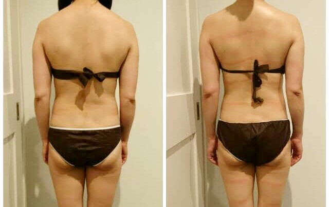 肩・肩甲骨周辺の変化で若返り