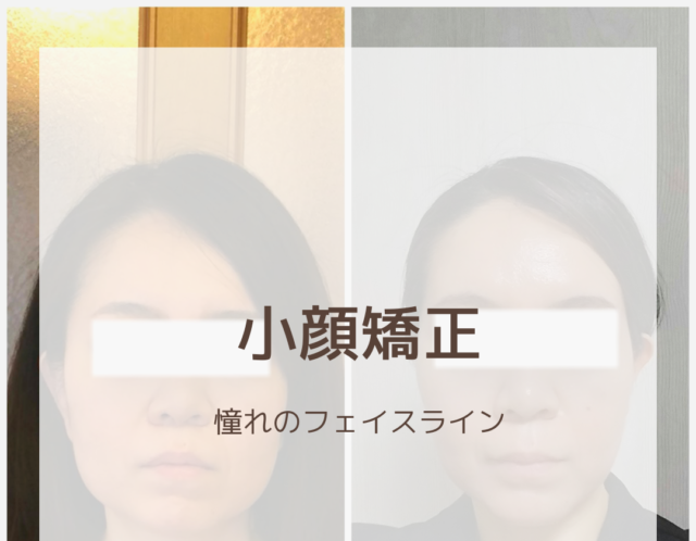 エラを育ててませんか？