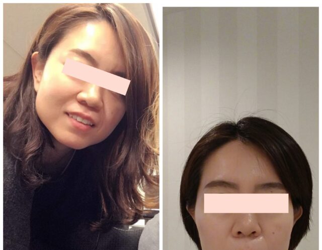 メンテナンスを続けると平面顔も変化する